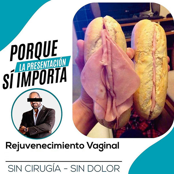 ad of dominican vaginoplastic surgeon
